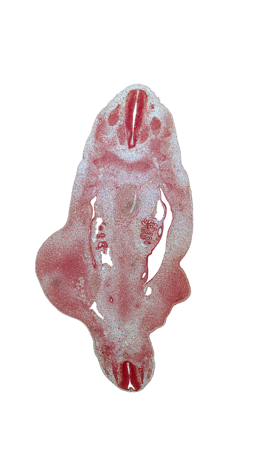 S-5 spinal ganglion, T-10 spinal nerve, T-9 spinal ganglion, blastema of rib 11, central canal, edge of mesonephros, intermediate zone, marginal zone, medial thigh, mesonephric duct, metanephric diverticulum, spinal cord, ventricular zone