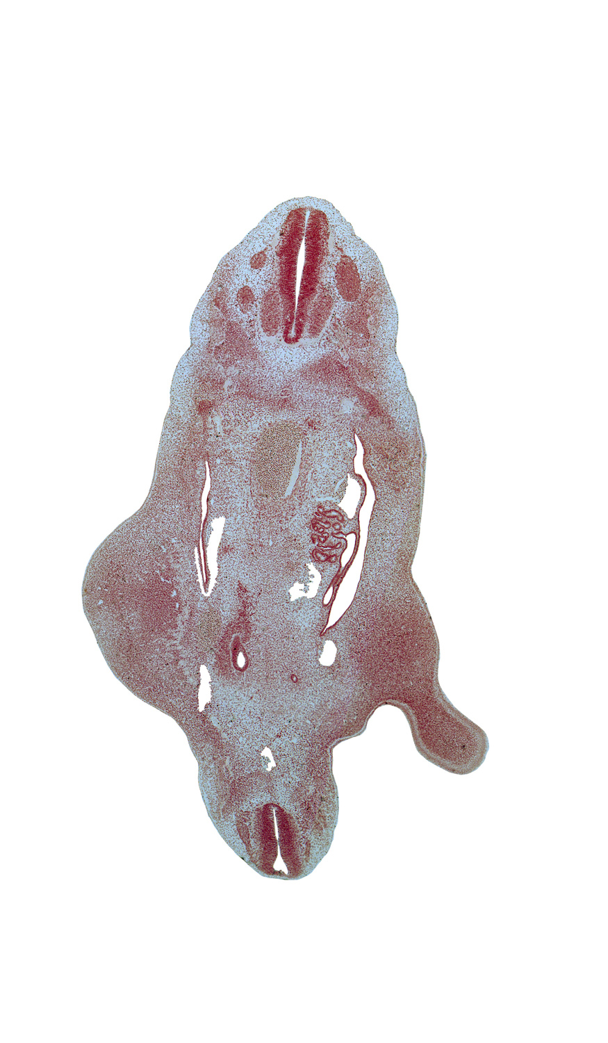 S-4 spinal nerve, T-10 spinal nerve, T-10 ventral root(s), T-9 spinal ganglion, aorta, blastema of rib 11, continuity of caudal and cephalic parts of mesonephric duct, femoral vessels, lower limb, mesonephros, notochord, peritoneal cavity, primordial meninx, skeletal blastema of femur