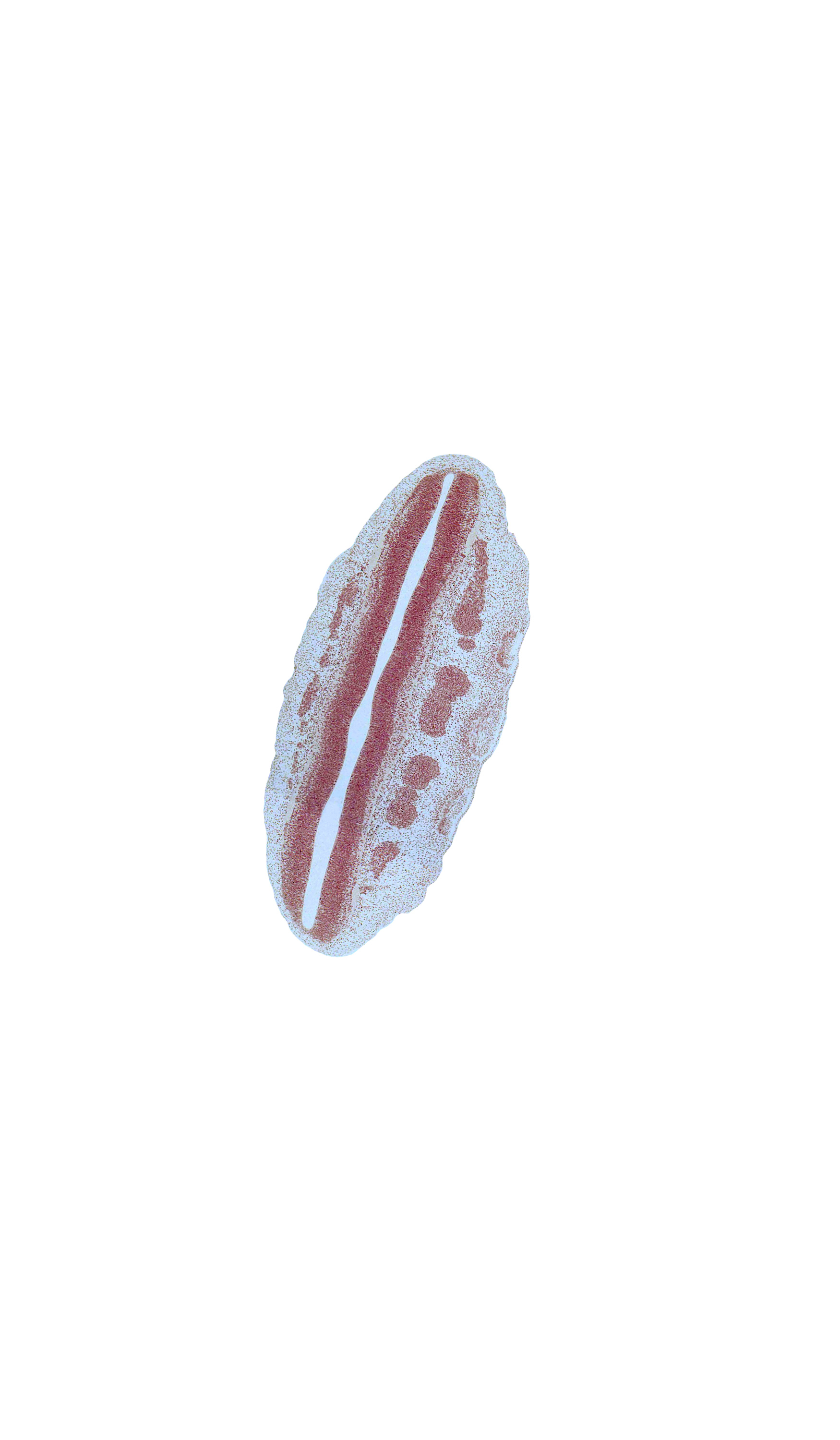 L-2 spinal ganglion, L-3 spinal ganglion, L-4 spinal ganglion, L-5 spinal ganglion, central canal, dorsal root(s)