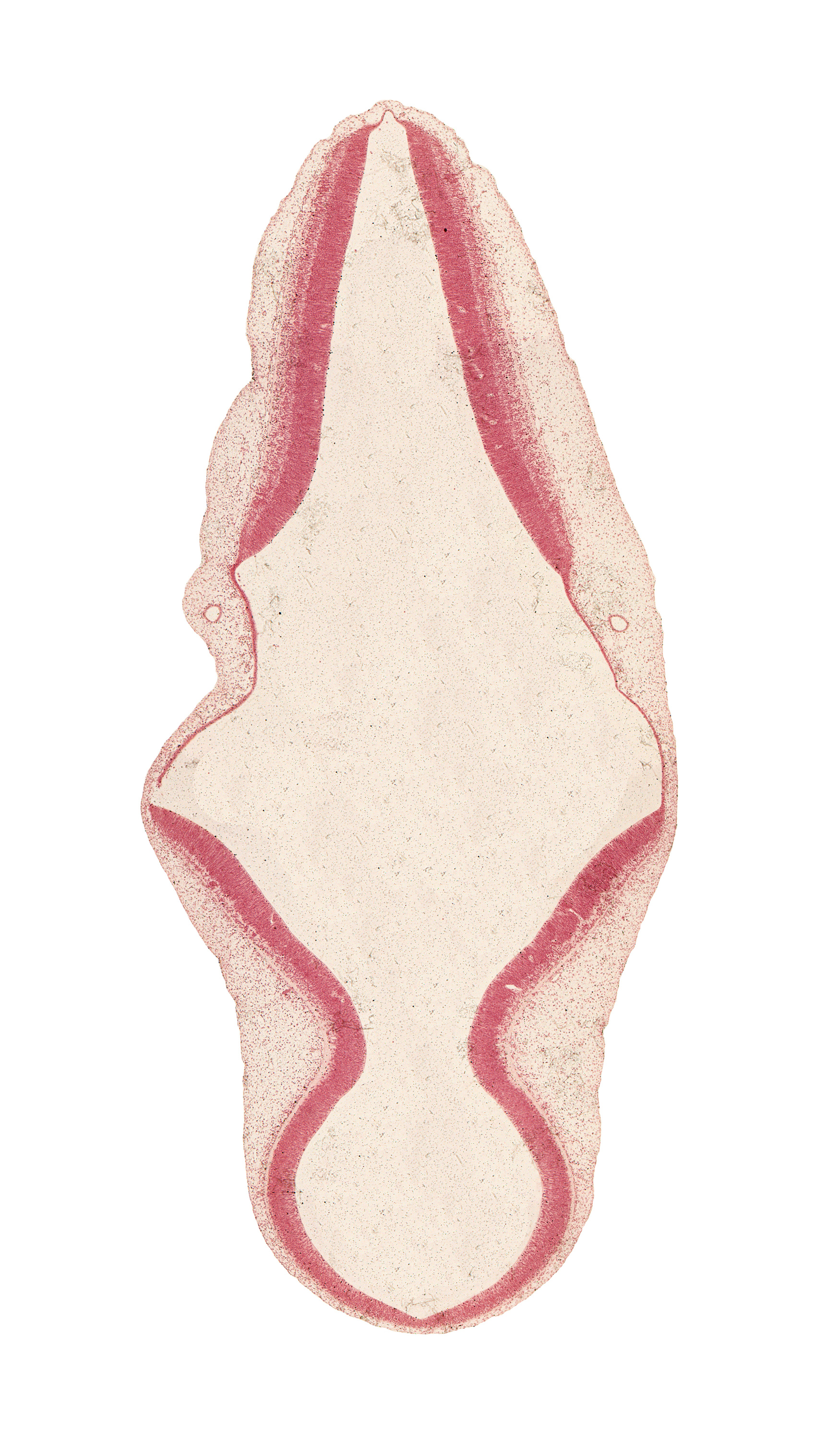 artifact separation(s), endolymphatic duct, intermediate zone, mesencephalon, mesencoel (cerebral aqueduct), primordial meninx, rhombencoel (fourth ventricle), roof plate of myelencephalon, roof plate of rhombencephalon, surface ectoderm, tectum, tegmentum, trochlear nerve (CN IV), ventricular zone