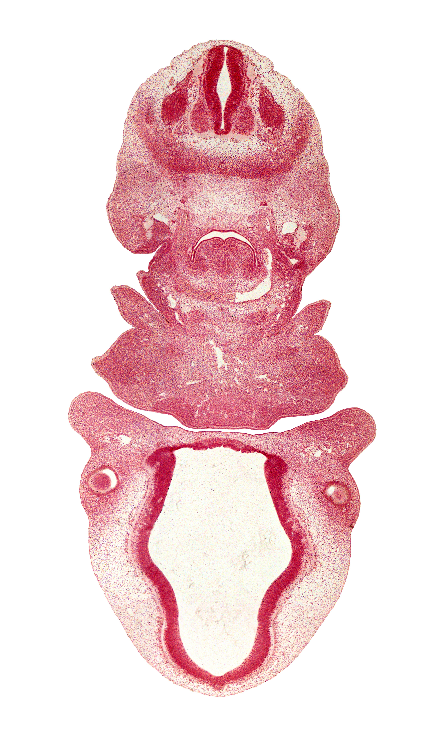 C-3 spinal ganglion, aortic sac, condensation around optic cup, dense caudal part of sclerotome, dorsal aorta, dorsal fasciculus, front part of tongue, head mesenchyme, hypoglossal nerve (CN XII), junction of aortic arches 4 and 6 and horn of aortic sac, laryngeal condensation, maxillary prominence of pharyngeal arch 1, maxillary vein, optic chiasma (chiasmatic plate), oral fissure, oronasal cavity, precardinal vein, surface ectoderm, sympathetic trunk, third ventricle, vagus nerve (CN X)