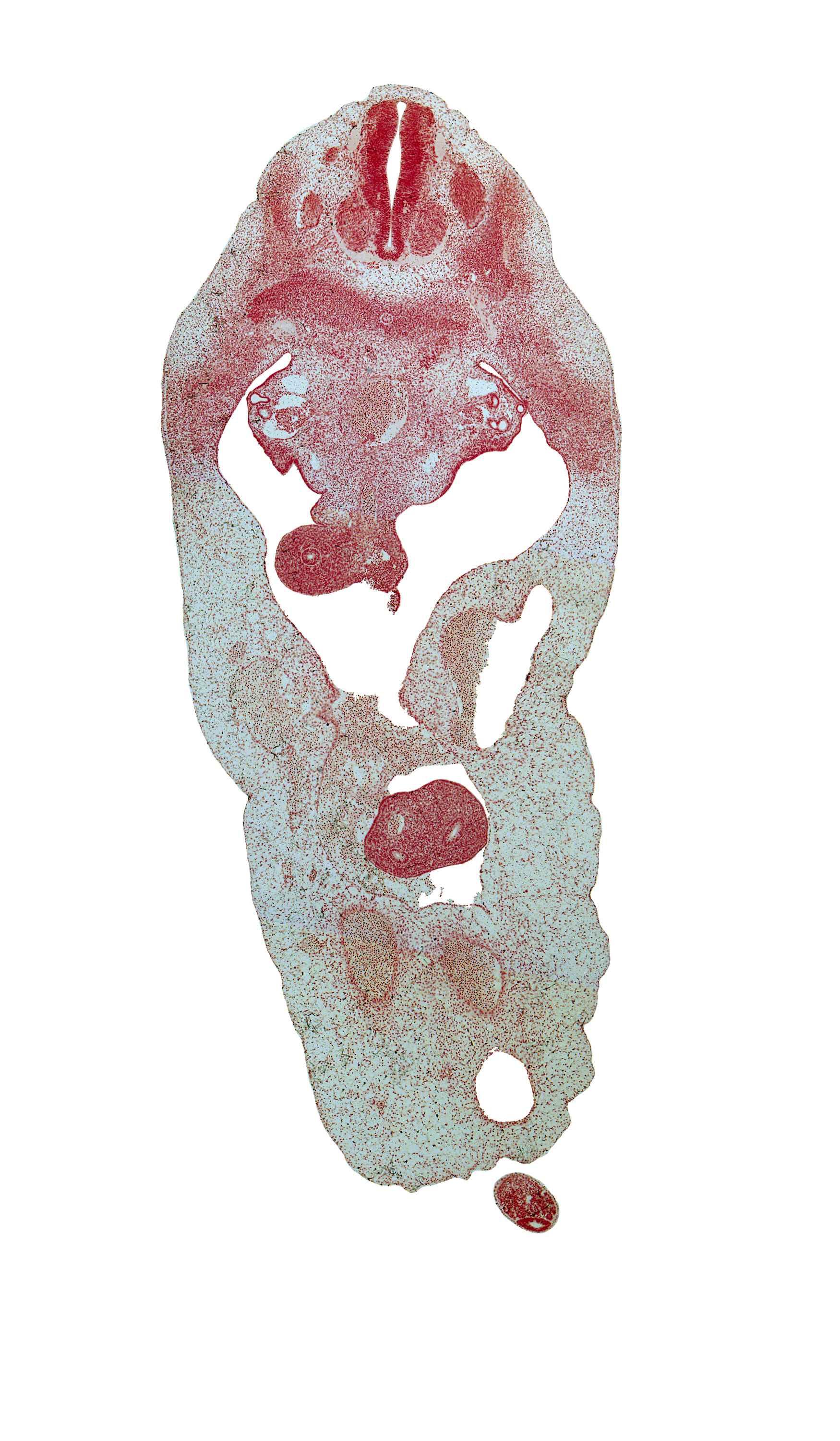 T-4 spinal ganglion, T-5 spinal nerve, allantois, aorta, celiac plexus, cephalic edge of gonadal ridge, distal limb of herniated midgut, duodenum, left umbilical artery, neural arch, peritoneal cavity, postcardinal vein, proximal limb of herniated midgut, right umbilical artery, subcardinal vein, superior mesenteric vessels, umbilical coelom, umbilical vein