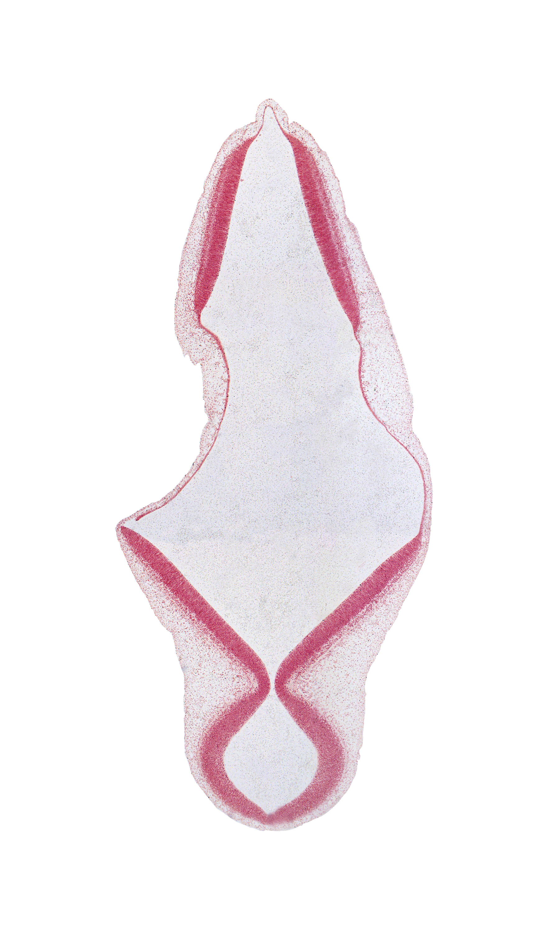 artifact separation(s), depression artifact, intermediate zone, mesencephalon, roof plate of myelencephalon, roof plate of rhombencephalon, trochlear nerve (CN IV), vascular plexus, ventricular zone