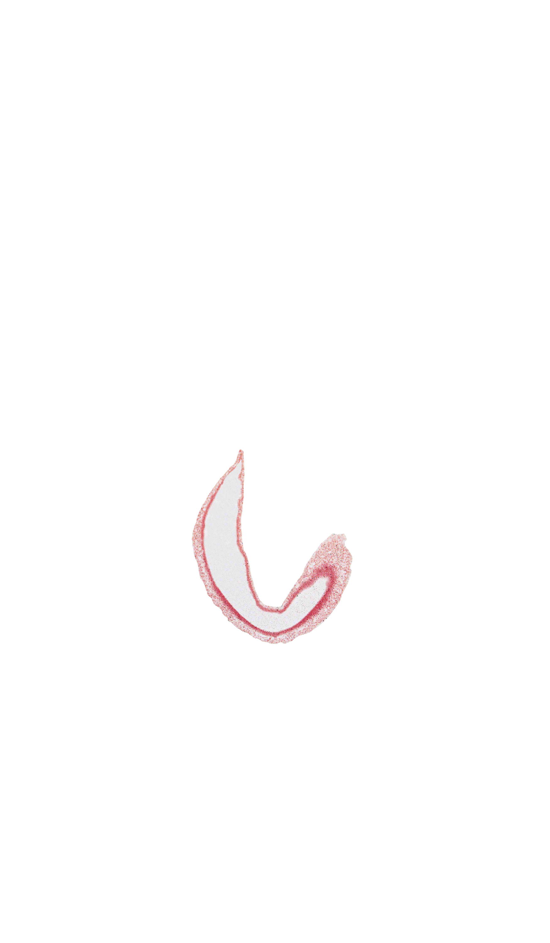head mesenchyme, rhombencoel (fourth ventricle), roof plate of rhombencephalon, surface ectoderm