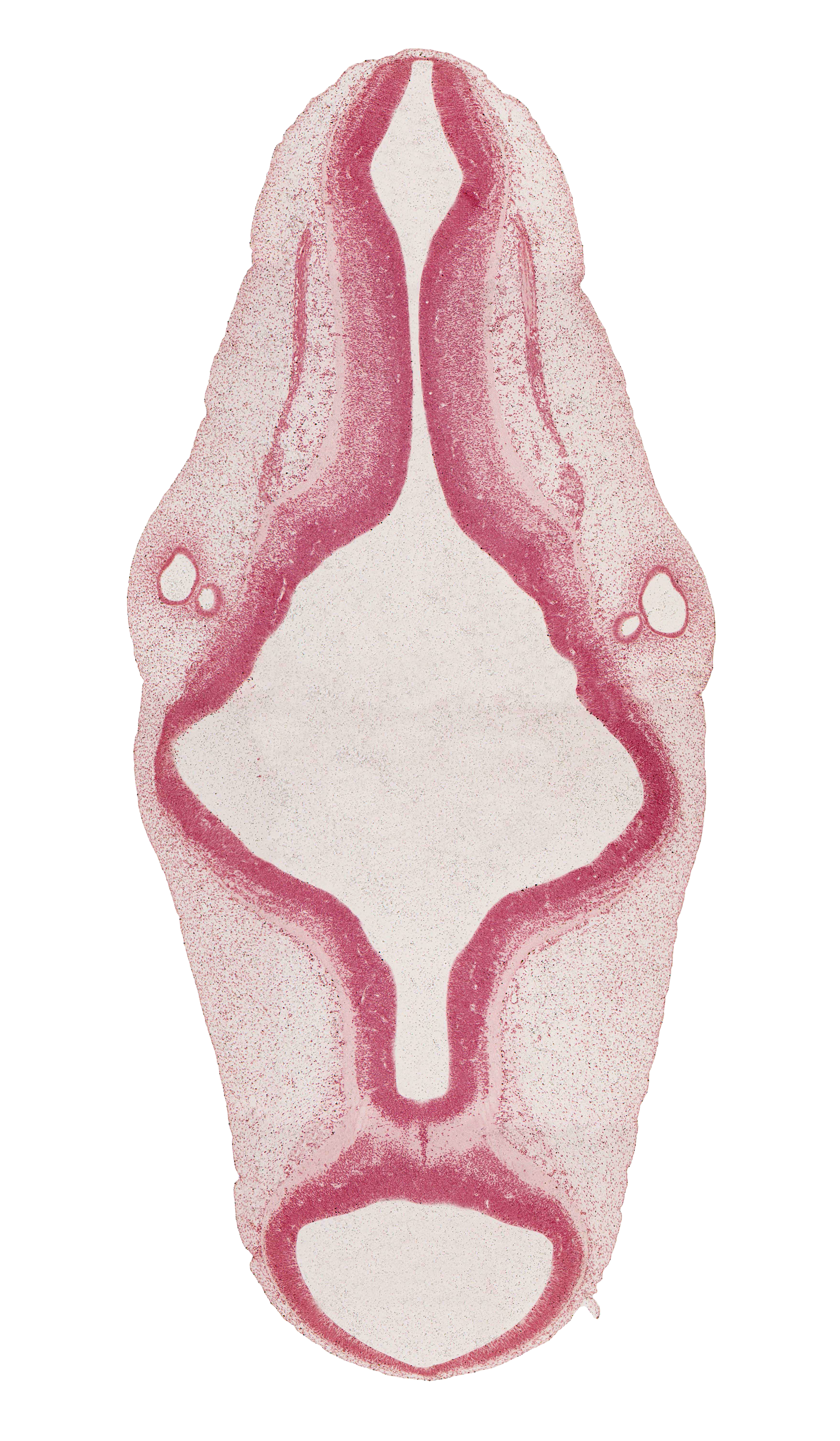 accessory nerve (CN XI), basis pedunculi of pons region (metencephalon), isthmus of rhombencephalon, mesencephalon (M2), metencephalon, myelencephalon, rhombencoel (fourth ventricle), rhombomere 4, rhombomere 5, rhombomere 6, rhombomere 7, roof plate, roof plate of rhombencephalon, sulcus limitans, tectum, tegmentum, vascular plexus