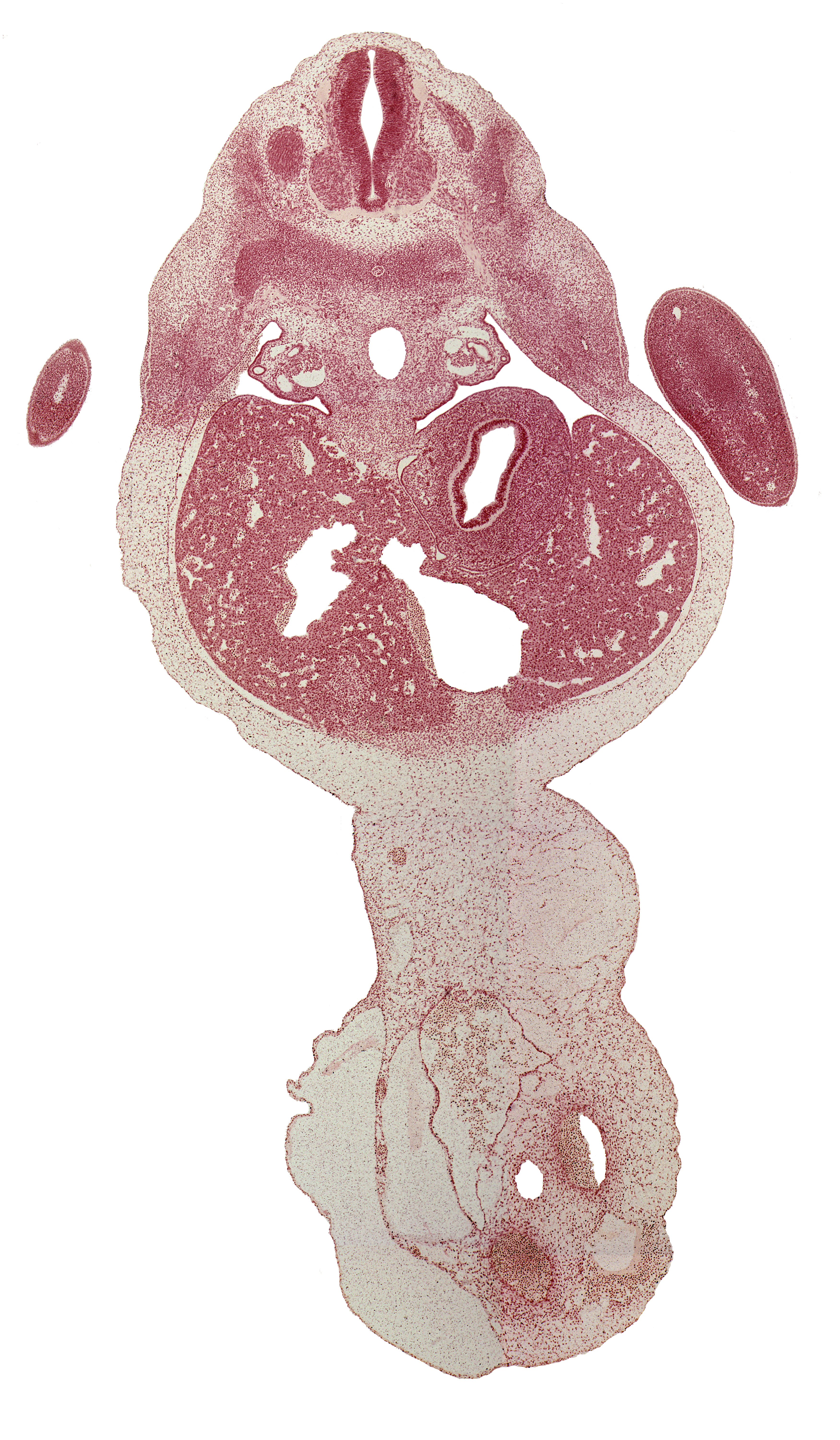 T-1 spinal ganglion, T-2 intercostal nerve, T-2 spinal nerve, afferent hepatic vein, aorta, bare area of liver, caudal edge of hand plate, central canal, ductus venosus, left lobe of liver, marginal vein, mesonephric duct, neural arch, peritoneal cavity, right lobe of liver, umbilical cord