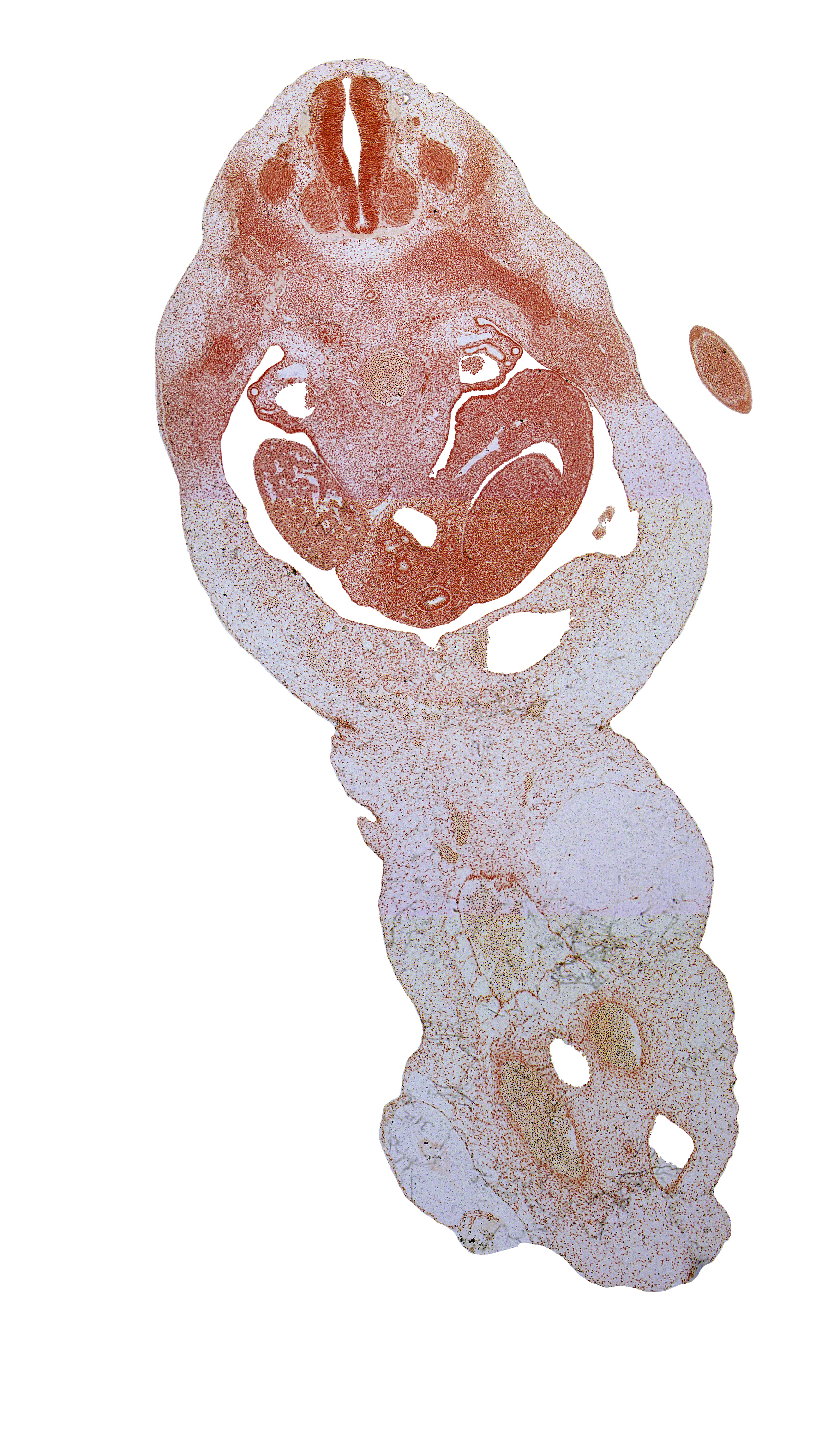 T-3 spinal ganglion, T-3 ventral root, amnion, aorta, blastema of rib 4, duodenum, edge of left lobe of liver, hand plate, mesonephric capsule, mucoid connective tissue, notochord, peritoneal cavity, right lobe of liver, umbilical vein