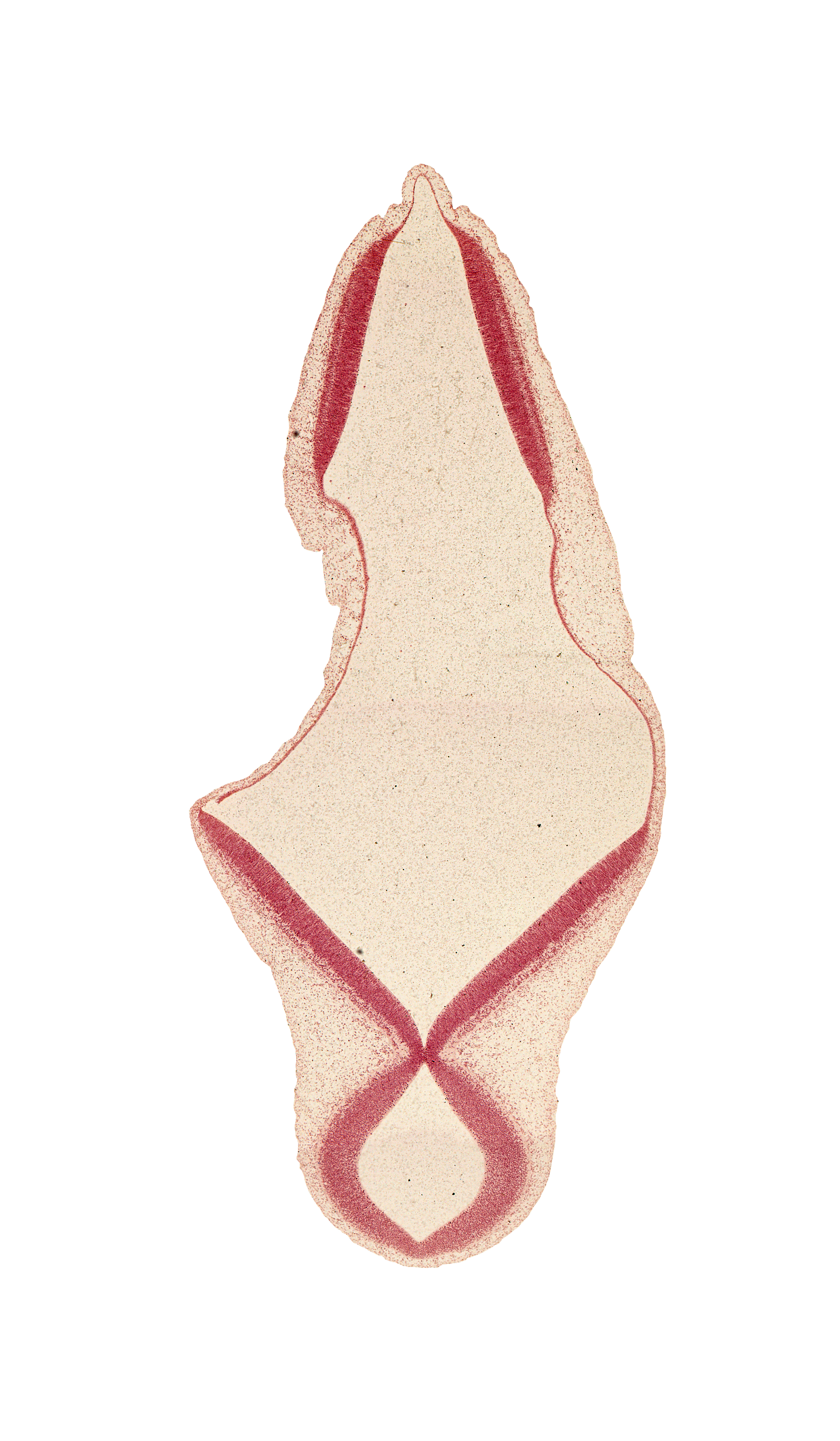 alar plate of myelencephalon, artifact separation(s), edge of isthmus of rhombencephalon, intermediate zone, mesencoel (cerebral aqueduct), rhombencoel (fourth ventricle), roof plate of myelencephalon, roof plate of rhombencephalon, trochlear nerve (CN IV), ventricular zone