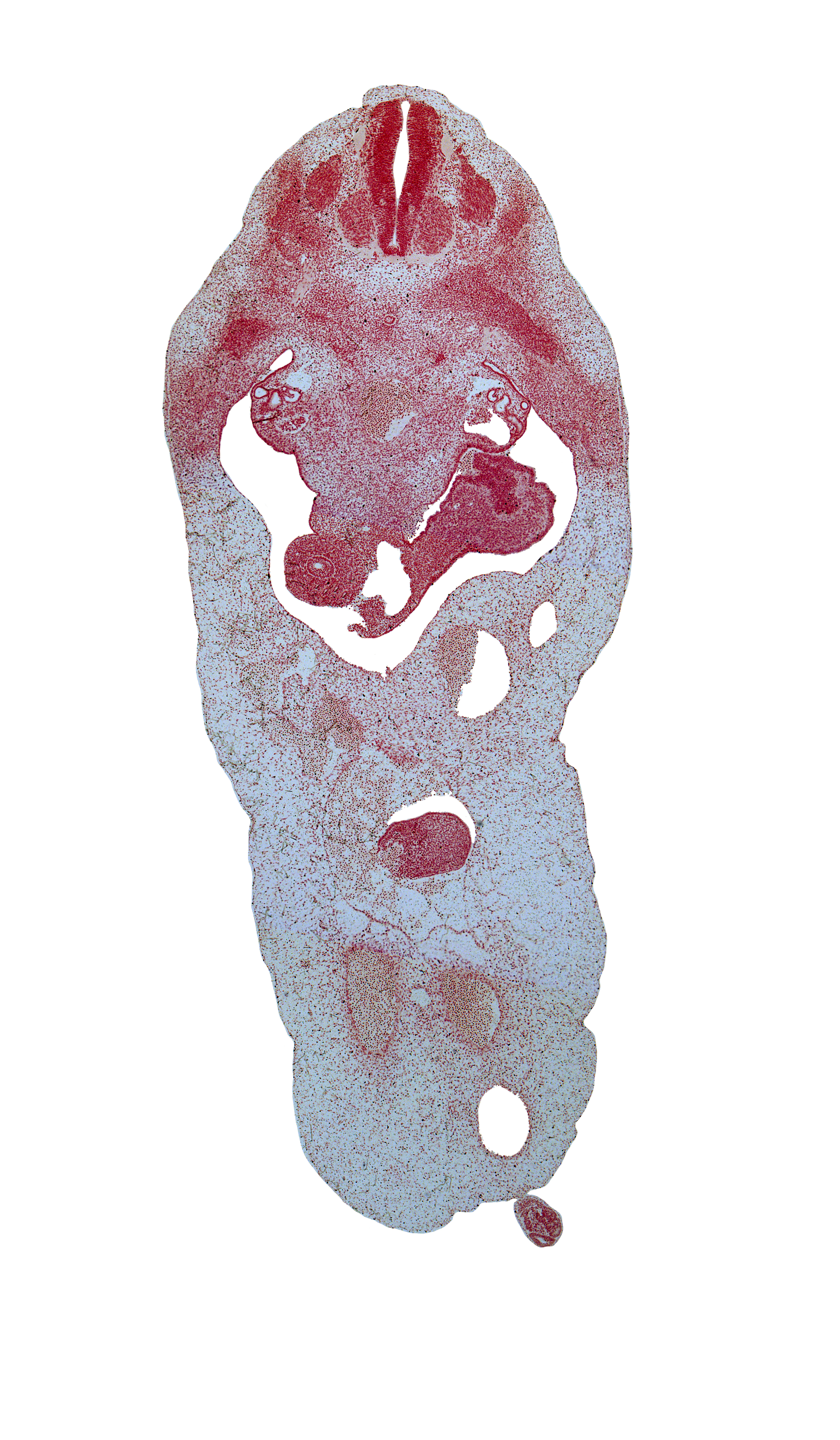T-4 intercostal nerve, allantois, aorta, blastema of rib 5, duodenum, herniated midgut mesenchyme, involuting right umbilical vein, left umbilical artery, notochord, primordial filum terminale, right umbilical artery, rupture point of superior mesenteric vein, superior mesenteric artery, superior mesenteric vein, umbilical coelom, umbilical vein