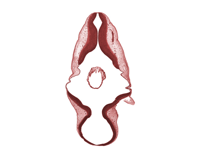 accessory nerve (CN XI), artifact separation(s), basal plate of myelencephalon, endolymphatic duct, exterior of embryo, isthmus of rhombencephalon, root of vagus nerve (CN X), sulcus limitans, trochlear nerve (CN IV)