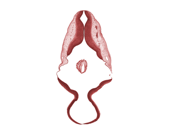 accessory nerve (CN XI), infolded roof plate, metencephalon, missing tissue (artifact), myelencephalon, root of vagus nerve (CN X)