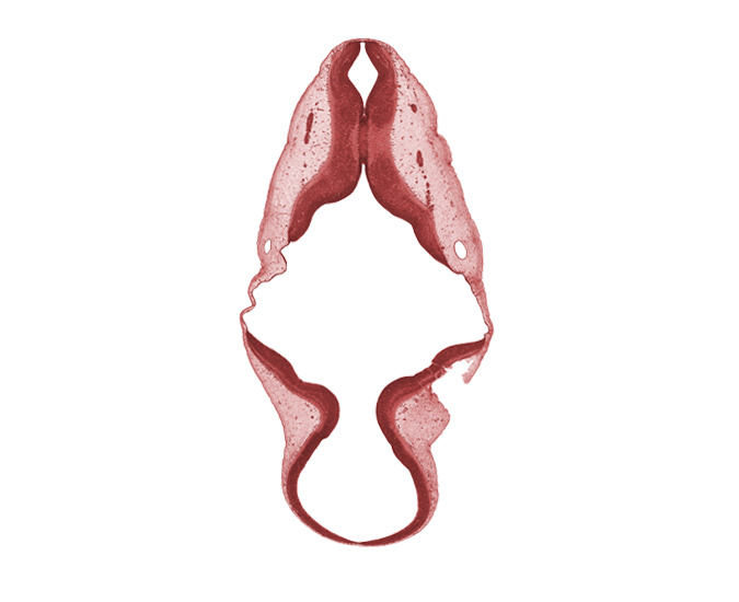 accessory nerve (CN XI), alar plate(s), artifact separation(s), basal plate, endolymphatic duct, roof plate, root of vagus nerve (CN X), sulcus limitans, tectum, tegmentum