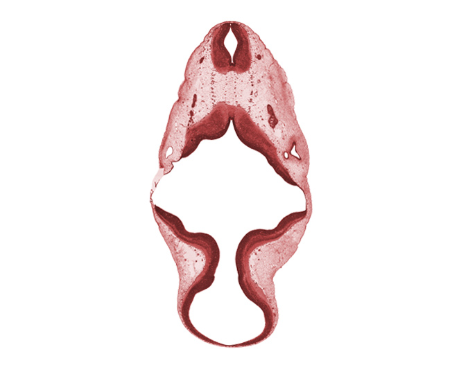 C-1 spinal ganglion, accessory nerve (CN XI), alar plate of metencephalon (cerebellum), disrupted tissue (artifact), intermediate zone, marginal zone, roof plate, root of hypoglossal nerve (CN XII), trochlear nerve (CN IV), vagus nerve (CN X), ventricular zone