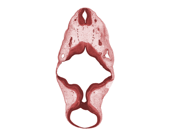 C-1 spinal ganglion, C-1 ventral root, accessory nerve (CN XI), alar plate of metencephalon (cerebellum), alar plate(s), basal plate, missing tissue (artifact), oculomotor nerve (CN III), rhombomere 5, roof plate, roof plate of rhombencephalon, root of glossopharyngeal nerve (CN IX), sulcus limitans, superior ganglion of vagus nerve (CN X), trochlear nerve (CN IV), vertebral artery