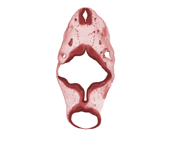 C-1 spinal ganglion, C-1 ventral root, accessory nerve (CN XI), edge of otic capsule condensation, edge of root of vestibulocochlear nerve (CN VIII), glossopharyngeal nerve (CN IX), missing tissue (artifact), roof plate of rhombencephalon, root of hypoglossal nerve (CN XII), spinal accessory nerve (CN XI), vagus nerve (CN X), vertebral artery