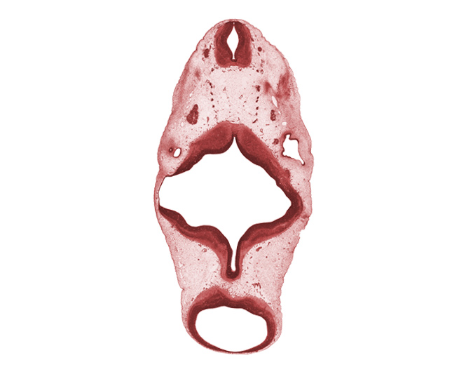 C-1 spinal ganglion, C-1 ventral root, cerebral peduncle, edge of anterior semicircular duct, junction of endolymphatic duct and vestibular part of otic vesicle, median sulcus, oculomotor nerve (CN III), rhombencoel (fourth ventricle), rhombomere 4, root of hypoglossal nerve (CN XII), trochlear nerve (CN IV), vertebral artery