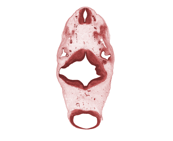 C-1 spinal nerve, C-2 spinal ganglion, anterior semicircular duct, artifact(s), median sulcus, mesencephalon, metencephalon, oculomotor nerve (CN III), posterior semicircular duct, rhombomere 2, rhombomere 3, rhombomere 4, root of hypoglossal nerve (CN XII), spinal accessory nerve (CN XI), trochlear nerve (CN IV), vagus nerve (CN X), vertebral artery