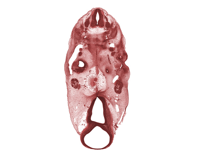 C-3 spinal ganglion, abducens nerve (CN VI), basal plate cartilage, basilar artery, basisphenoid condensation, cochlear duct, cochlear ganglion (CN VIII), dorsal fasciculus, edge of cochlear duct, edge of metencephalon (pons), edge of pharyngeal pouch 1, epimere, hypoglossal nerve (CN XII), internal carotid artery, missing tissue (artifact), neural arch, notochord, precardinal vein, sclerotome, sternocleidomastoid / trapezius muscle, sulcus limitans