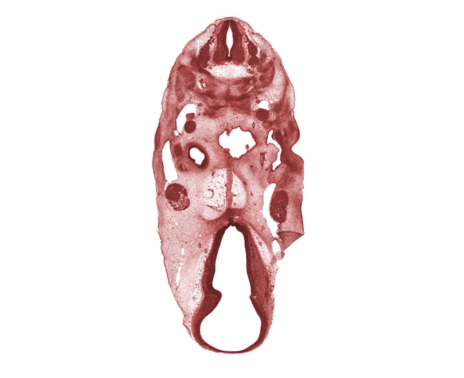 C-3 spinal ganglion, C-4 spinal ganglion, anterior dural venous plexus, basal plate condensation, basilar artery, dural limiting layer, edge of oronasal cavity, glossopharyngeal nerve (CN IX), inferior ganglion of vagus nerve (CN X), missing tissue (artifact), neurohypophyseal bud, notochord, oculomotor nerve (CN III), pharyngeal groove 1, spinal accessory nerve (CN XI), subarachnoid space, tissue fold (artifact), trigeminal ganglion (CN V), vertebral artery