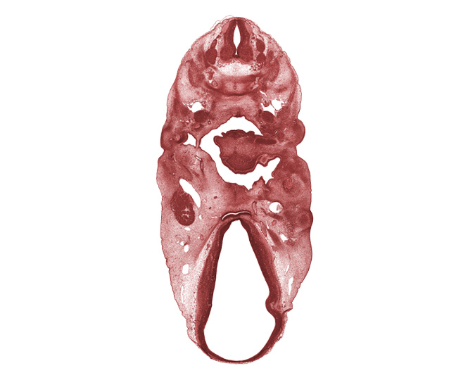 C-4 spinal ganglion, C-5 spinal ganglion, abducens nerve (CN VI), adenohypophysial pouch, basisphenoid condensation, chorda tympani nerve, dorsal fasciculus, dorsal thalamus, epimere, epithalamus, fiber field, glossopharyngeal nerve (CN IX), hypoglossal nerve (CN XII), hypothalamus, internal carotid artery, mandibular nerve (CN V₃), maxillary nerve (CN V₂), neural arch, notochord, oculomotor nerve (CN III), ophthalmic nerve (CN V₁), retropharyngeal space, sternocleidomastoid / trapezius muscle, tissue fold (artifact), tongue, ventral thalamus