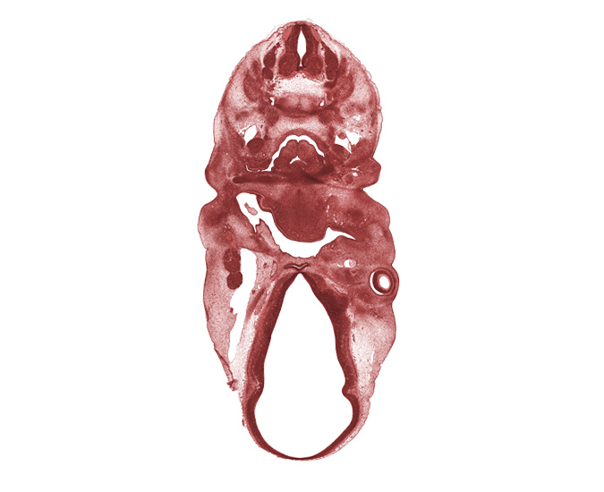 C-4 spinal nerve, C-5 spinal ganglion, adenohypophysial pouch, artifact(s), arytenoid swelling, dorsal sulcus, edge of optic stalk (CN II), intraretinal space (optic vesicle cavity), laryngeal pharynx, marginal ridge, maxillary vein, middle sulcus, optic cup cavity, pharyngeal groove 1, pharyngeal pouch 2, precartilage condensation of pharyngeal arch 1 (Meckel), retropharyngeal space, spinal accessory nerve (CN XI), third ventricle, vagus nerve (CN X), ventral (hypothalamic) sulcus, vertebral artery