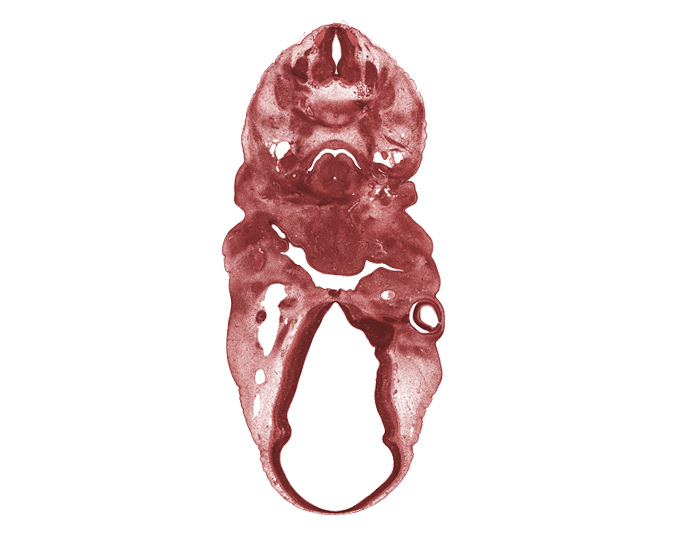 C-5 spinal ganglion, anterior dural venous plexus, auricular hillock, epimere, head mesenchyme, internal carotid artery, laryngeal pharynx, nasopharynx, neural arch, opening of adenohypophysial pouch, primary head vein, spinal accessory nerve (CN XI), sternocleidomastoid muscle, surface ectoderm, thyroglossal duct, trapezius muscle, vascular plexus