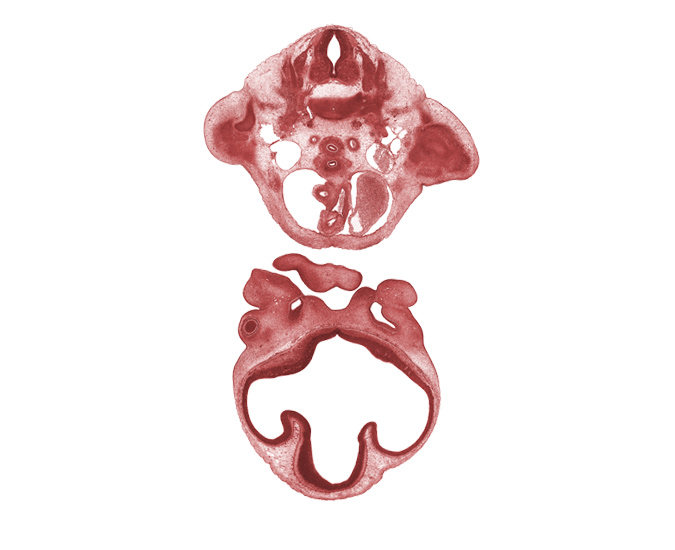 C-8 spinal ganglion, ascending aorta, brachial plexus, dorsal aorta, esophagus endoderm, left atrium, lumen of nasal sac, maxillary prominence of pharyngeal arch 1, medial nasal prominence(s), nasal disc (olfactory placode), nasal septum, pericardial cavity, phrenic nerve, precardinal vein, pulmonary semilunar valve, pulmonary trunk, roof of diencephalon, striatal part of cerebral vesicle (telencephalon), suprastriatal part of cerebral vesicle (telencephalon), torus hemisphericus, trachea (endoderm)