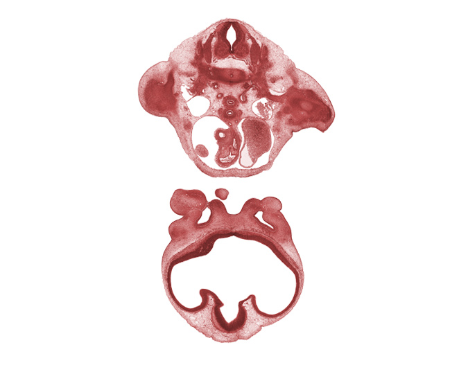 C-8 spinal ganglion, C-8 spinal nerve, alar plate(s), ascending aorta, basal plate, corpus striatum, dorsal intersegmental artery, edge of mandibular prominence of pharyngeal arch 1, edge of right atrium, floor plate, humerus cartilage, lumen of nasal sac, maxillary prominence of pharyngeal arch 1, medial nasal prominence(s), meninx, nasal fin, olfactory filia (CN I), precardinal vein, pulmonary semilunar valve, roof plate, sulcus limitans