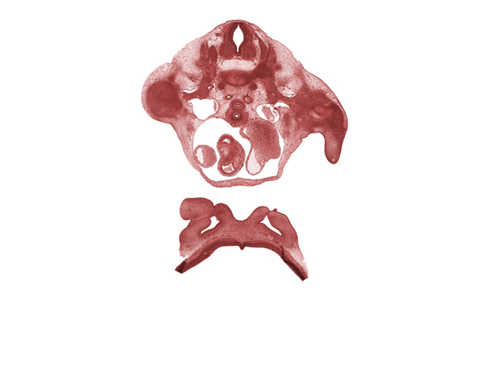 T-1 spinal ganglion, alar plate(s), arm region, ascending aorta, basal plate, esophagus endoderm, floor plate, forearm region, lumen of nasal sac, missing tissue (artifact), musculi pectinati in left atrial wall, nasomaxillary groove, right atrium, roof plate, subclavian artery, subclavian vein, sulcus limitans, trachea (endoderm)