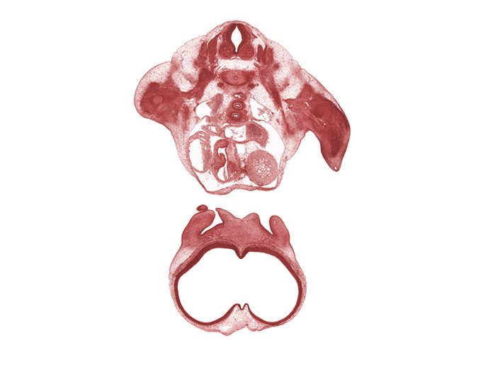 T-1 spinal ganglion, aorta, cerebral vesicle (telencephalon), edge of maxillary prominence of pharyngeal arch 1, head mesenchyme, left ventricle, naris, nasal capsule, nasal disc (olfactory placode), olfactory filia (CN I), phrenic nerve, rib 1, right atrium, right pulmonary artery, secondary interatrial foramen (foramen secundum), subclavian artery, surface ectoderm, telencephalon medium, tracheal bifurcation, tuberculum olfactorium, undivided truncus arteriosus