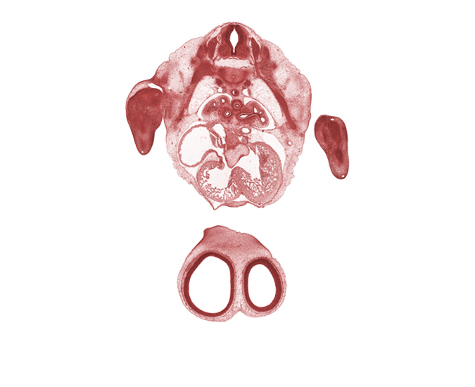 T-2 spinal nerve, T-3 intercostal nerve, T-3 spinal ganglion, central canal, edge of interventricular foramen, edge of peritoneal cavity, forearm region, hand plate, heart prominence, left atrioventricular canal, muscular part of interventricular septum, pleural cavity, right atrioventricular canal, right atrium, sinus venosus, tertiary bronchopulmonary buds in lower lobe of left lung