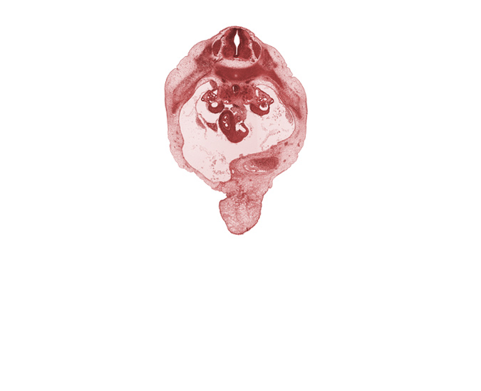 T-10 spinal ganglion, aorta, caudal edge of right lobe of liver, central canal, duodenum (second part), gonadal ridge, junction of bile duct and ventral pancreatic duct, neural arch, peritoneal cavity, rib 11, superior mesenteric artery, superior mesenteric vein, umbilical cord, umbilical vein