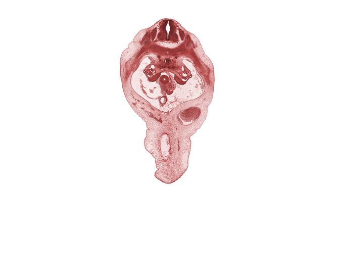 T-11 spinal ganglion, duodenum, edge of umbilical coelom, involuting right umbilical vein, postcardinal vein, rib 12, superior mesenteric artery, superior mesenteric vein, sympathetic trunk, umbilical cord, umbilical vein