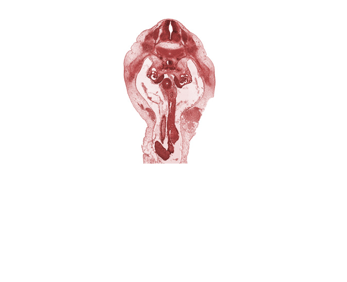 T-12 dorsal root, T-12 spinal ganglion, T-12 ventral root, duodenum, lateral coelomic bay, medial coelomic bay, missing tissue (artifact), notochord, superior mesenteric artery, superior mesenteric vein