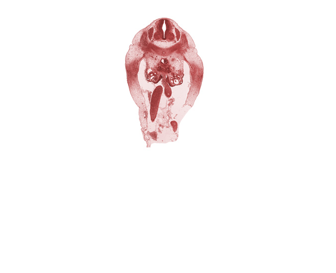 L-1 spinal ganglion, abdominal wall, aorta, hindgut endoderm, mesonephric duct, midgut condensation, missing tissue (artifact), notochord, sympathetic trunk