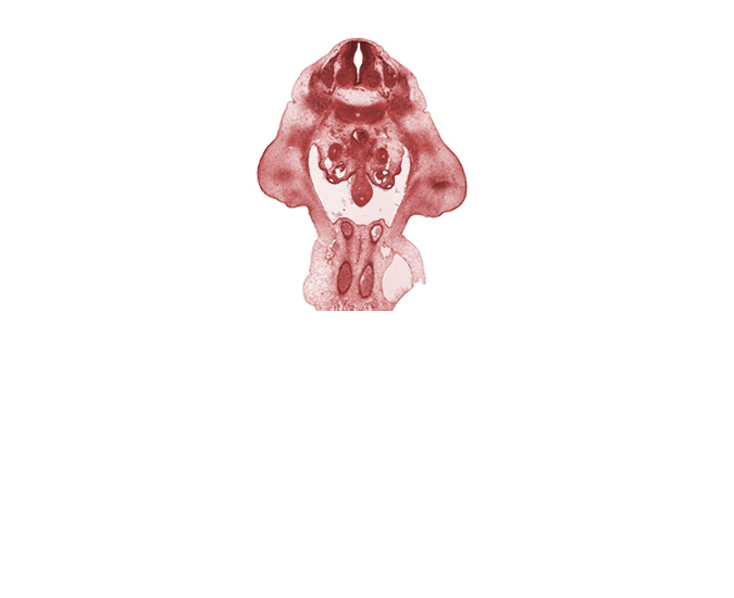 L-2 spinal ganglion, aorta, edge of allantois, hindgut, inferior mesenteric artery, left umbilical artery, metanephrogenic blastema, missing tissue (artifact), pelvis of kidney (metanephros), peritoneal cavity, right umbilical artery, thigh