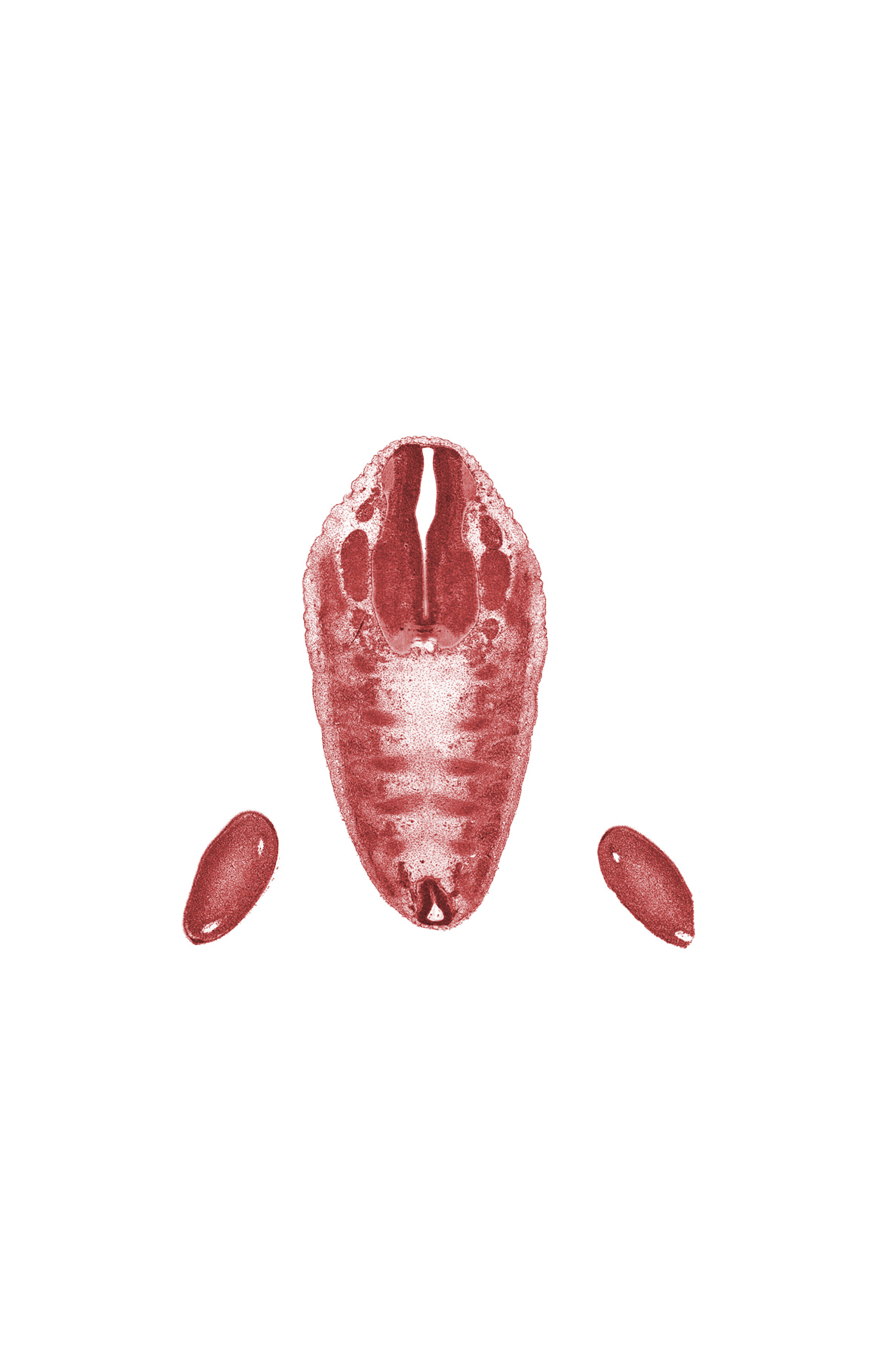 Co-1 ventral root, L-5 spinal ganglion, S-1 spinal ganglion, S-2 spinal ganglion, S-4 spinal nerve, alar plate(s), basal plate, dense caudal part of sclerotome, floor plate, foot plate, loose cephalic part of sclerotome, proximal limb of herniated midgut, roof plate, sulcus limitans