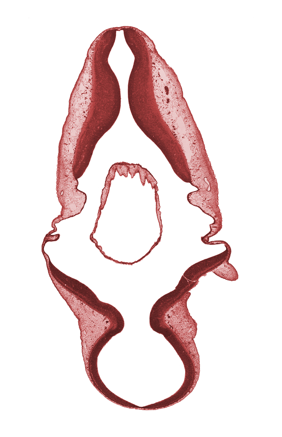 alar plate(s), basal plate, infolded roof plate of rhombencephalon, isthmus of rhombencephalon, mesencephalon (M2), mesencoel (cerebral aqueduct), rhombencoel (fourth ventricle), roof plate, roof plate of rhombencephalon, root of accessory nerve (CN XI), sulcus limitans, trochlear nerve (CN IV)