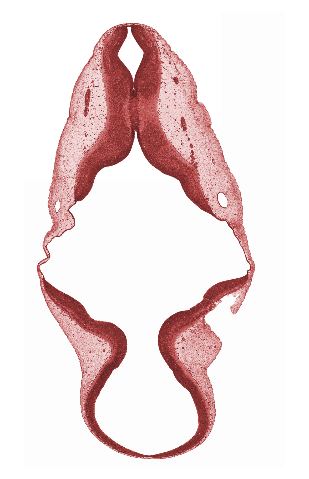 accessory nerve (CN XI), alar plate(s), artifact separation(s), basal plate, endolymphatic duct, roof plate, root of vagus nerve (CN X), sulcus limitans, tectum, tegmentum