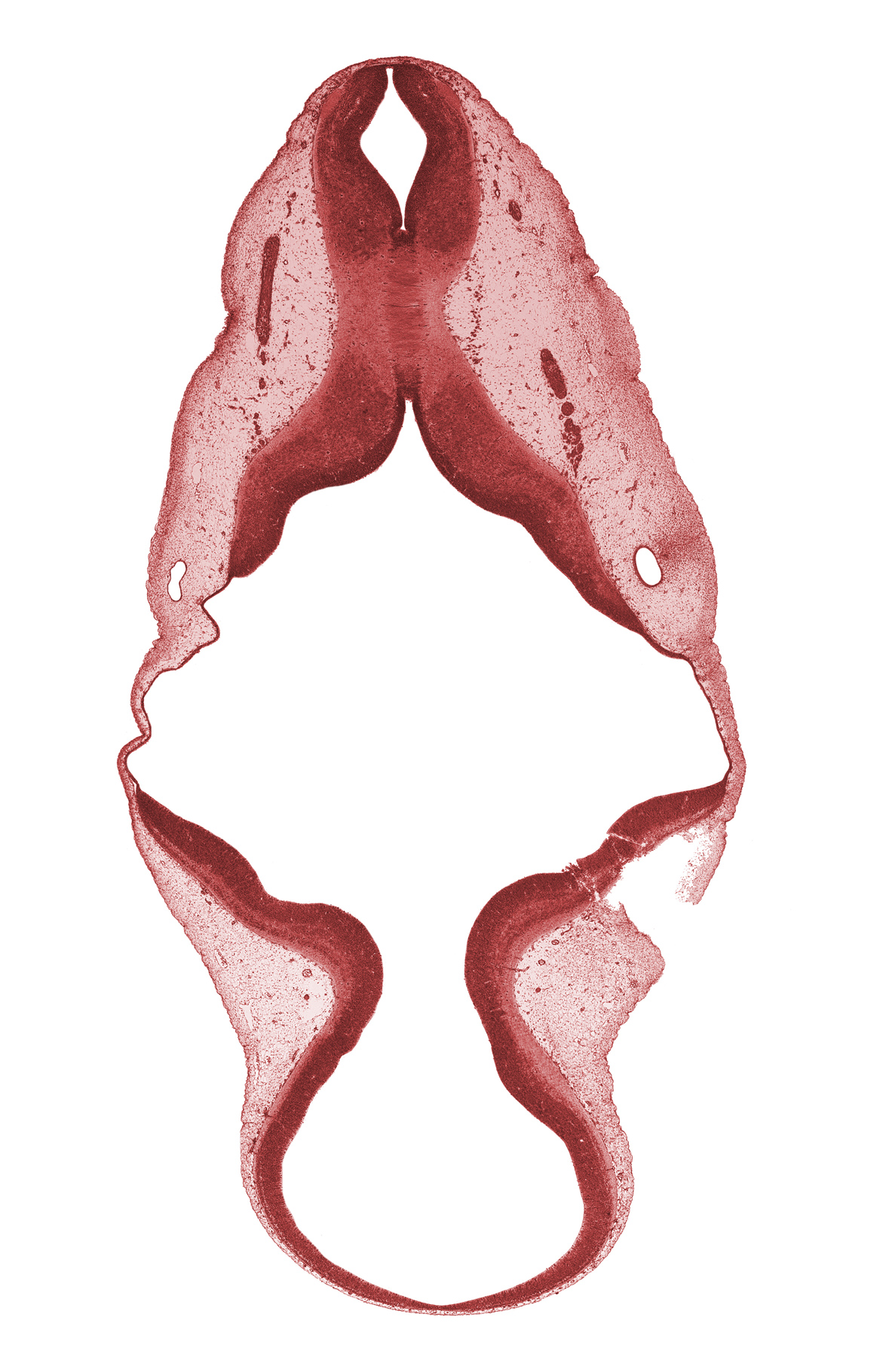 accessory nerve (CN XI), intermediate zone, marginal zone, mesencephalon (M2), missing tissue (artifact), otic capsule condensation, roof plate, root of vagus nerve (CN X), tectum, tegmentum, trochlear nerve (CN IV), ventricular zone
