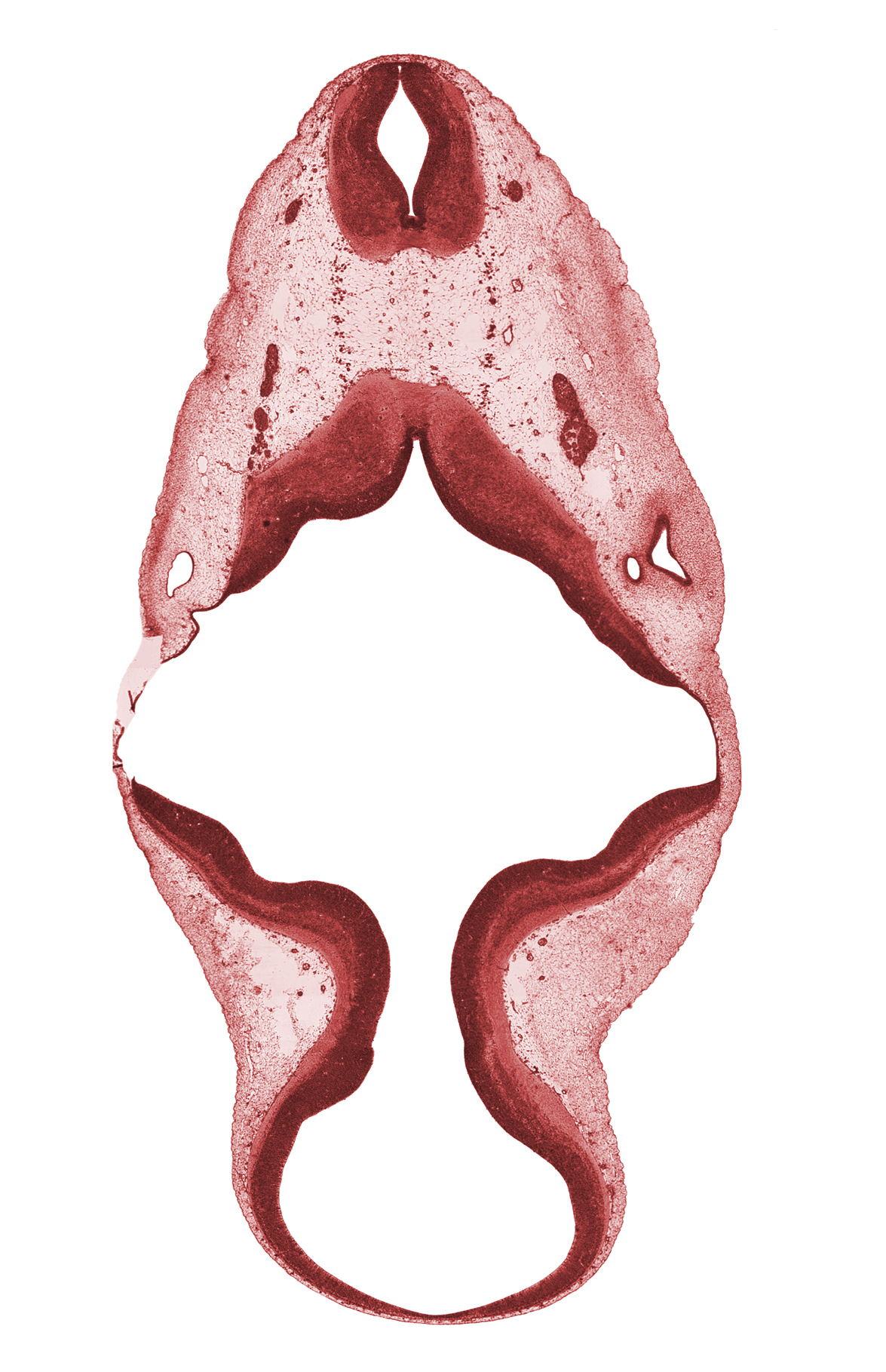 C-1 spinal ganglion, accessory nerve (CN XI), alar plate of metencephalon (cerebellum), disrupted tissue (artifact), intermediate zone, marginal zone, roof plate, root of hypoglossal nerve (CN XII), trochlear nerve (CN IV), vagus nerve (CN X), ventricular zone