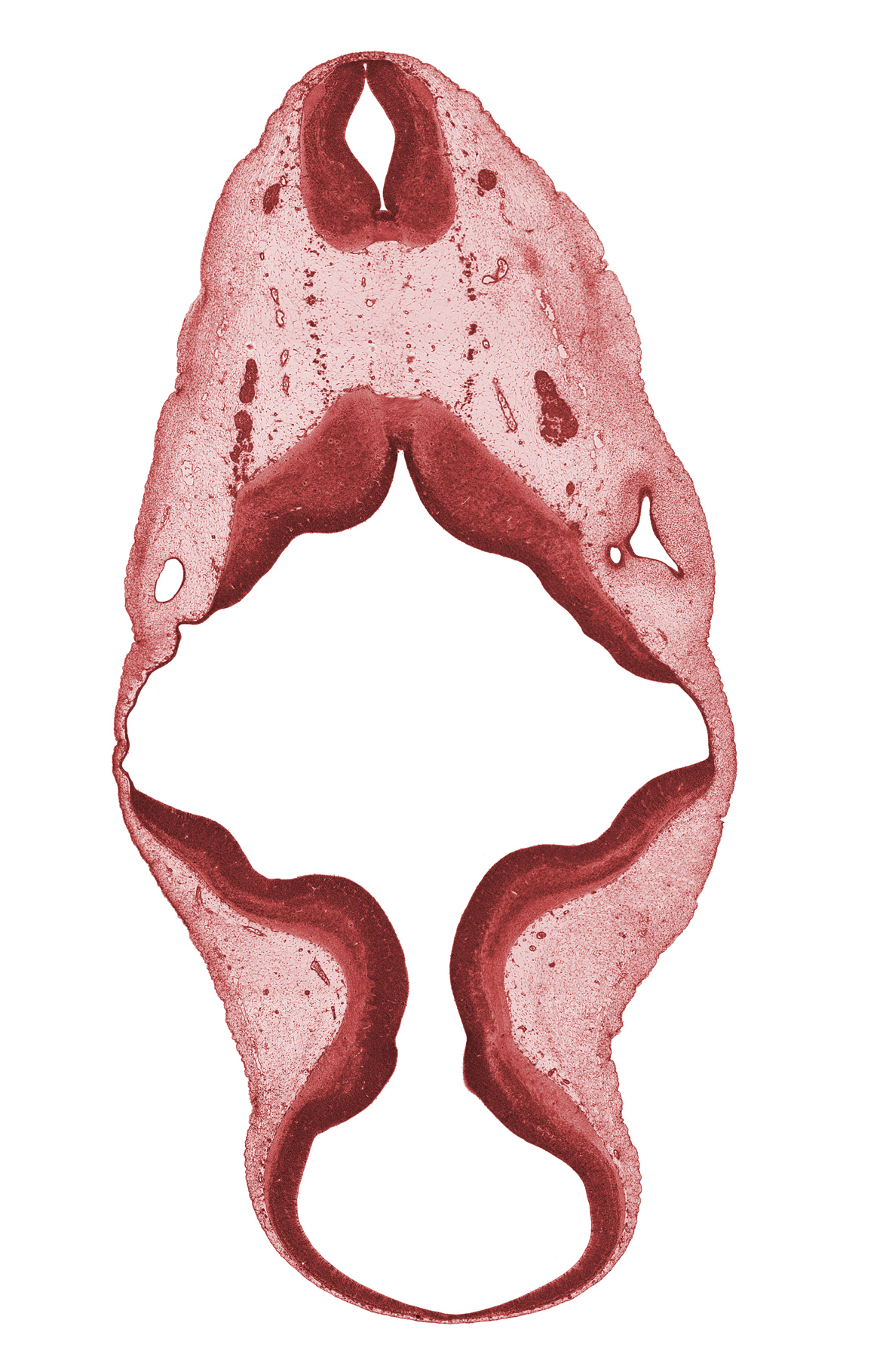 C-1 spinal ganglion, C-1 ventral root, alar plate(s), anterior semicircular duct, basal plate, endolymphatic duct, floor plate, mesencoel (cerebral aqueduct), posterior semicircular duct, rhombencoel (fourth ventricle), roof plate, root of hypoglossal nerve (CN XII), spinal accessory nerve (CN XI), sulcus limitans, vertebral artery