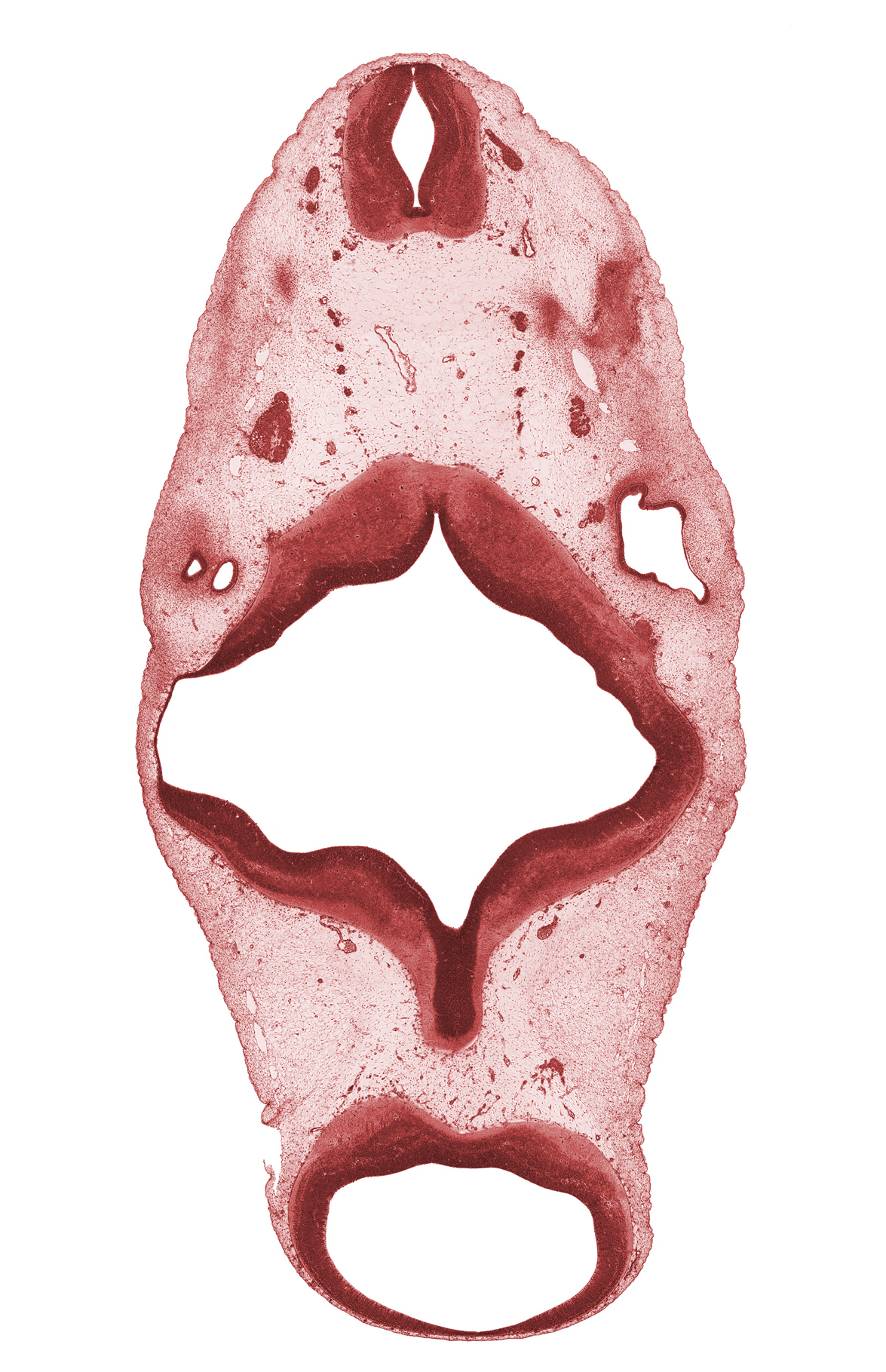 C-1 spinal ganglion, anterior semicircular duct, central canal, oculomotor nerve (CN III), region of mesencephalic (cephalic) flexure, rhombomere 2, rhombomere 4, spinal accessory nerve (CN XI), vagus nerve (CN X), vertebral artery