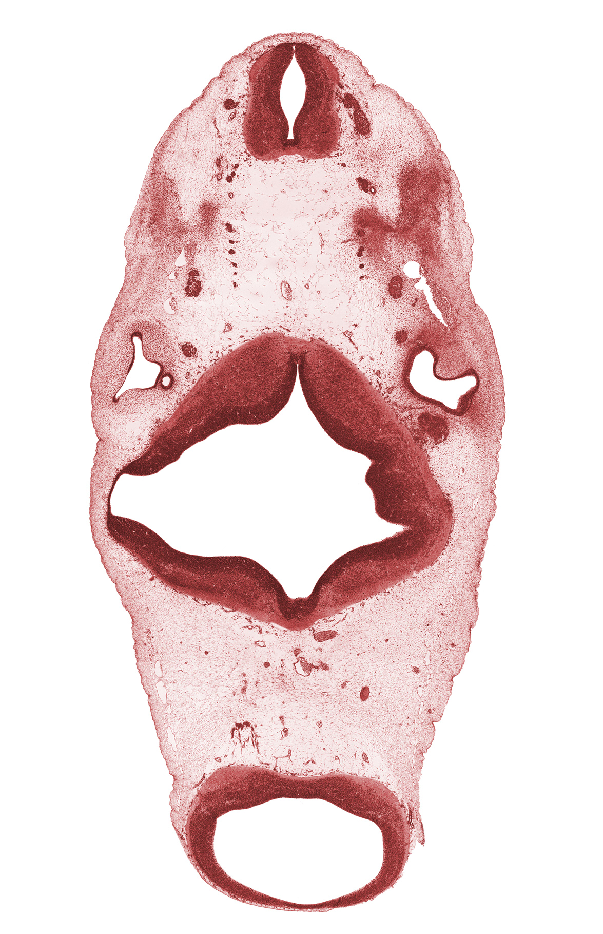 C-1 spinal nerve, C-2 spinal ganglion, anterior semicircular duct, artifact(s), median sulcus, mesencephalon, metencephalon, oculomotor nerve (CN III), posterior semicircular duct, rhombomere 2, rhombomere 3, rhombomere 4, root of hypoglossal nerve (CN XII), spinal accessory nerve (CN XI), trochlear nerve (CN IV), vagus nerve (CN X), vertebral artery