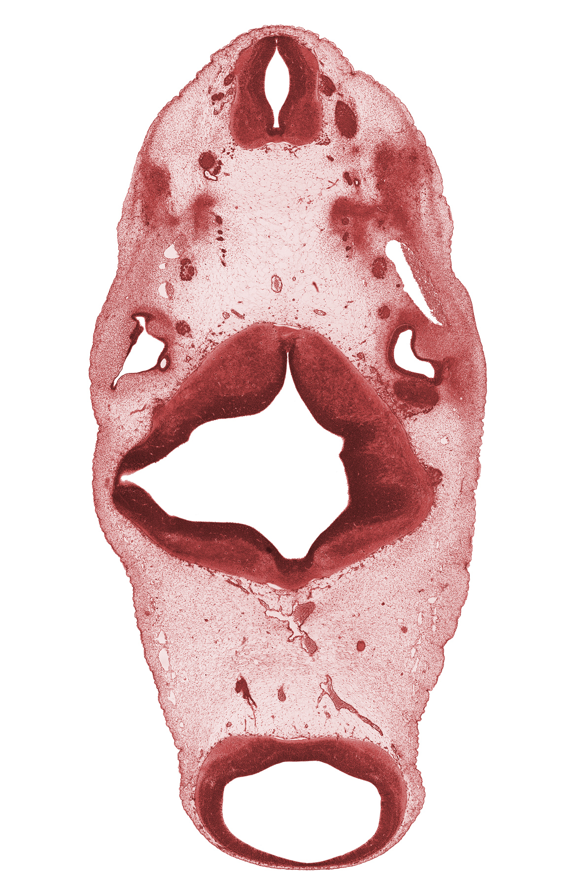 C-1 spinal nerve, C-2 spinal ganglion, C-2 ventral root, anterior semicircular duct, basilar artery, dorsal fasciculus, edge of root of trigeminal nerve (CN V), endolymphatic duct, epimere, glossopharyngeal nerve (CN IX), hypoglossal nerve (CN XII), mesencephalon, metencephalon, myelencephalon, oculomotor nerve (CN III), posterior cerebral artery, posterior semicircular duct, rhombencoel (fourth ventricle), rhombomere 1, trapezius muscle, trochlear nerve (CN IV), vestibulocochlear ganglion (CN VIII)