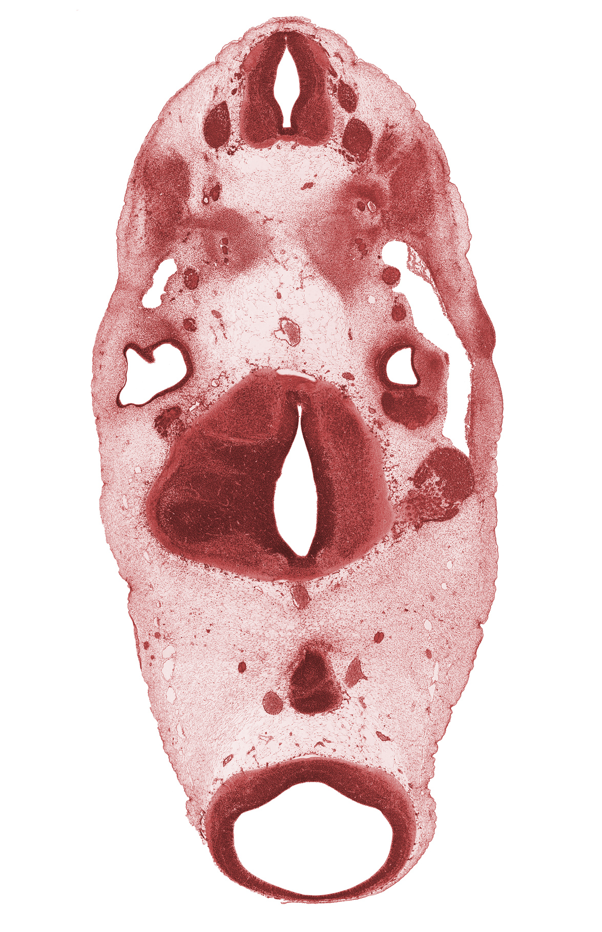 C-1 spinal nerve, C-2 spinal ganglion, C-3 spinal ganglion, anterior semicircular duct, basilar artery, facial nerve (CN VII), hypoglossal canal, intermediate zone, lateral semicircular duct, marginal zone, median sulcus, posterior communicating artery, precardinal vein, primary head vein, tectum, tegmentum, trigeminal ganglion (CN V), utriculosaccular diverticulum, ventricular zone, vertebral artery, vestibulocochlear ganglion (CN VIII)