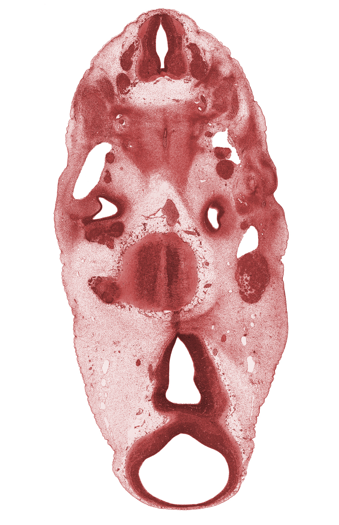 C-3 spinal ganglion, basal plate cartilage, dorsal primary ramus, epimere, geniculate ganglion (CN VII), inferior ganglion of glossopharyngeal nerve (CN IX), intermediate zone, mamillary region, marginal zone, mesencephalon (M1), mesencoel (cerebral aqueduct), motor root of trigeminal nerve (CN V), neural arch, notochord, precardinal vein, sclerotome, spinal accessory nerve (CN XI), third ventricle, vagus nerve (CN X)