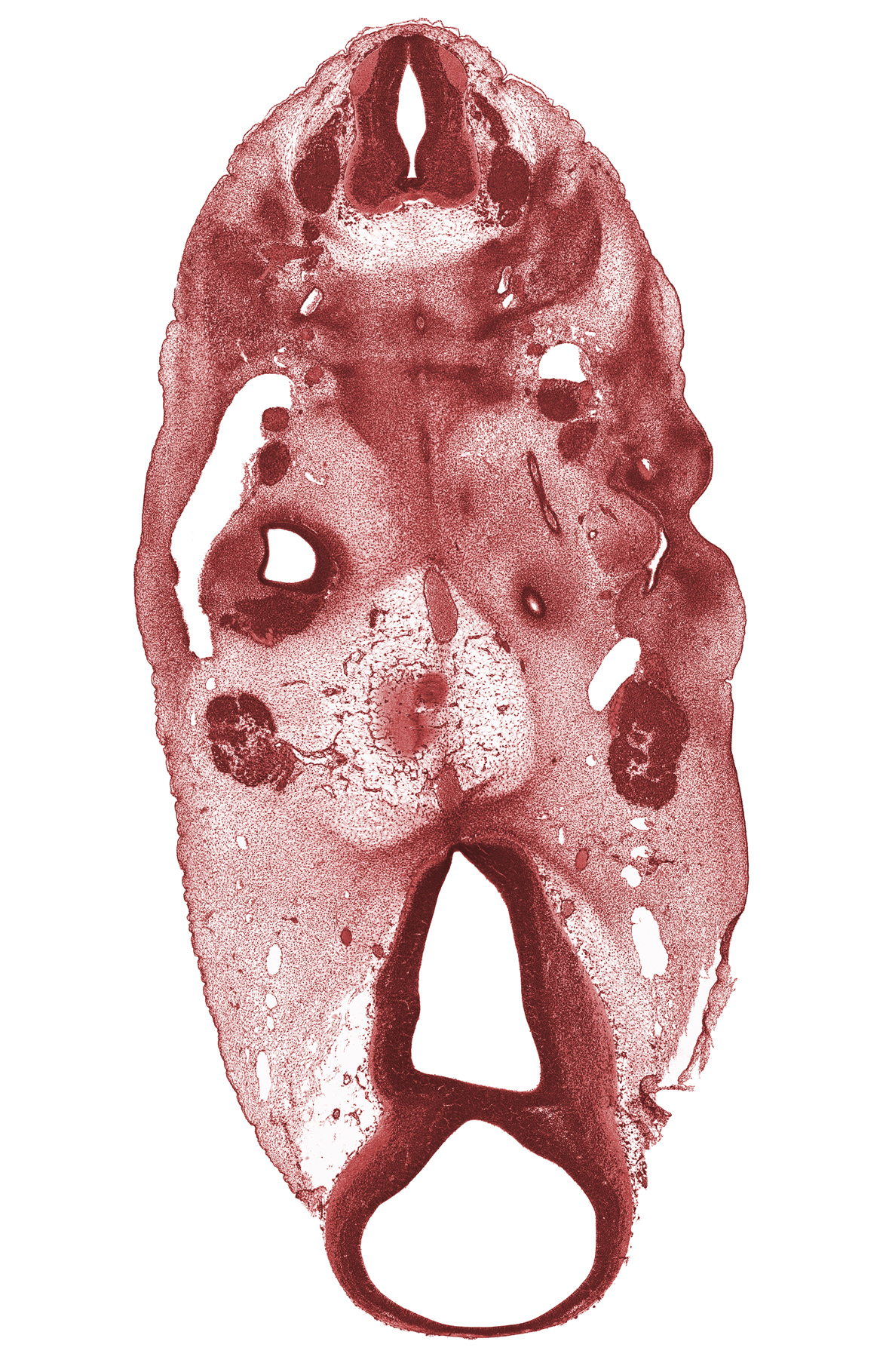 C-3 spinal ganglion, abducens nerve (CN VI), basal plate cartilage, basilar artery, basisphenoid condensation, cochlear duct, cochlear ganglion (CN VIII), dorsal fasciculus, edge of cochlear duct, edge of metencephalon (pons), edge of pharyngeal pouch 1, epimere, hypoglossal nerve (CN XII), internal carotid artery, missing tissue (artifact), neural arch, notochord, precardinal vein, sclerotome, sternocleidomastoid / trapezius muscle, sulcus limitans