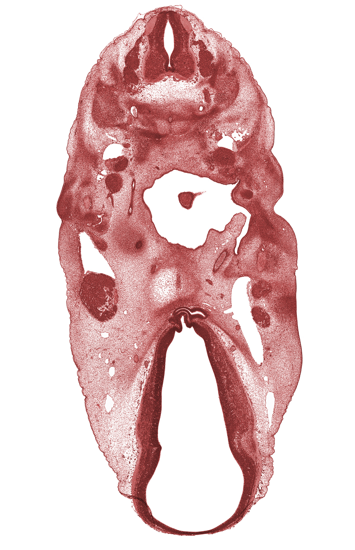 C-3 spinal nerve, C-4 spinal ganglion, abducens nerve (CN VI), adenohypophysial pouch, anterior dural venous plexus, basal plate condensation, cartilaginous vertebral centrum, dorsal thalamus, edge of tongue, epithalamus, hypoglossal nerve (CN XII), hypothalamus, internal carotid artery, mandibular nerve (CN V₃), maxillary nerve (CN V₂), missing tissue (artifact), neural arch, neurohypophyseal bud, oculomotor nerve (CN III), ophthalmic nerve (CN V₁), oronasal cavity, oropharynx, otic capsule condensation, pharyngeal pouch 1, pharyngeal pouch 2, precardinal vein, precartilage condensation of pharyngeal arch 2, spinal accessory nerve (CN XI), subthalamus, ventral thalamus