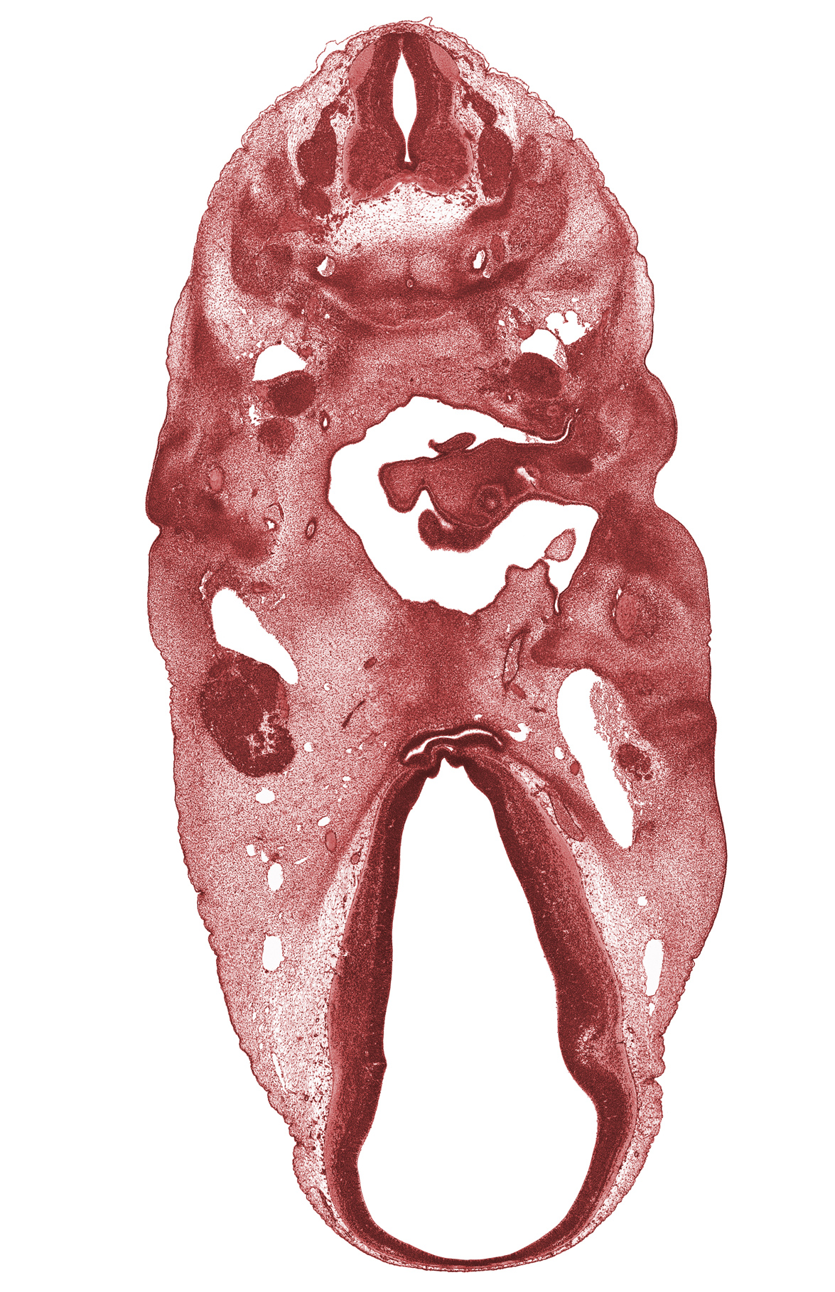 C-4 spinal ganglion, C-5 spinal ganglion, anterior dural venous plexus, basal plate condensation, cartilaginous vertebral centrum, dorsal sulcus, dural band for tentorium cerebelli, edge of otic capsule condensation, glossopharyngeal nerve (CN IX), intermediate zone, internal carotid artery, mandibular nerve (CN V₃), marginal zone, maxillary nerve (CN V₂), middle sulcus, ophthalmic nerve (CN V₁), orbitosphenoid condensation, oropharynx, pharyngeal pouch 2, primary head vein, third ventricle, trigeminal ganglion (CN V), tubotympanic recess (pharyngeal pouch 1), vagus nerve (CN X), ventral (hypothalamic) sulcus, ventricular zone